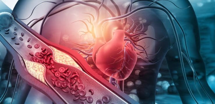 Vascular Surgery Department